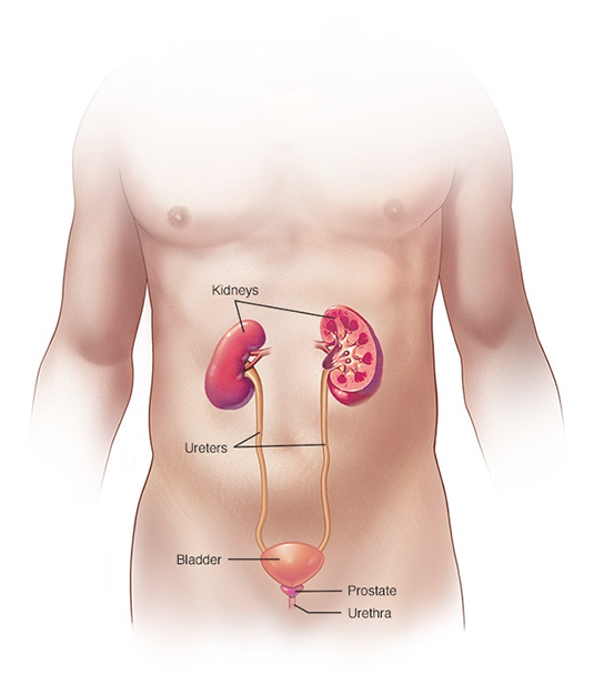 Bladder Cancer