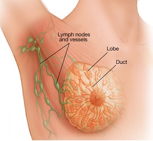 Breast Cancer
